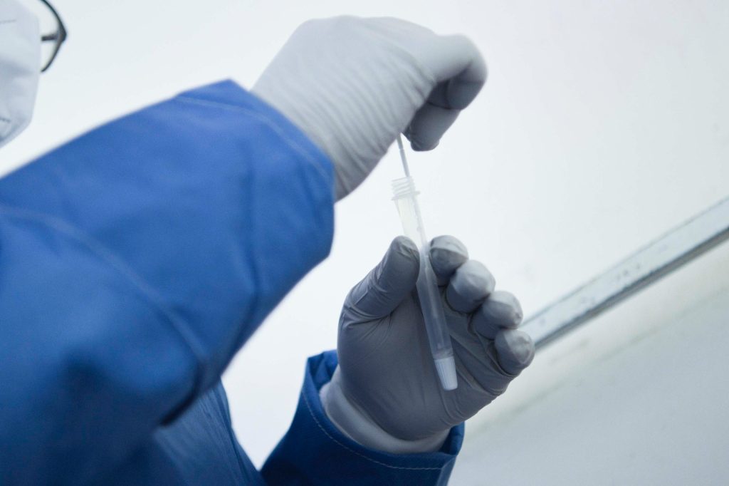 Suma Puebla siete nuevos contagios por COVID-19: Salud