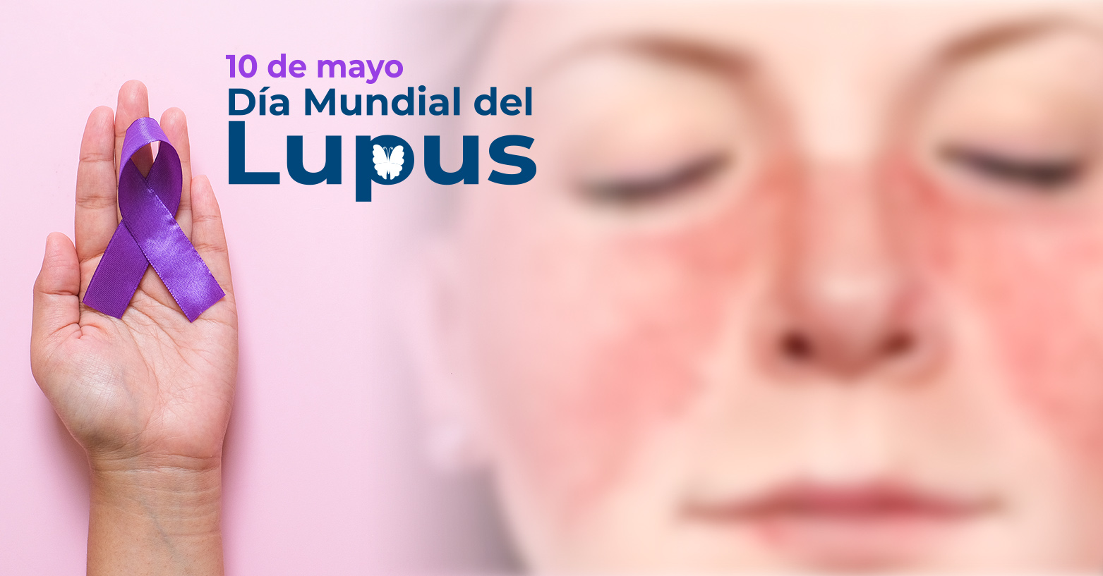 Día Mundial del Lupus
